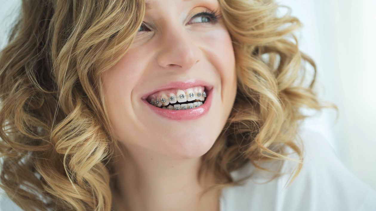 It's Never Too Late: Your Complete Guide to Adult Braces
