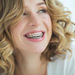It's Never Too Late: Your Complete Guide to Adult Braces
