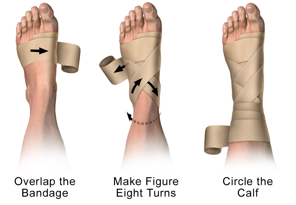 how to wrap an ankle