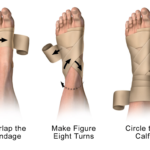 How to wrap an ankle: Complete guide