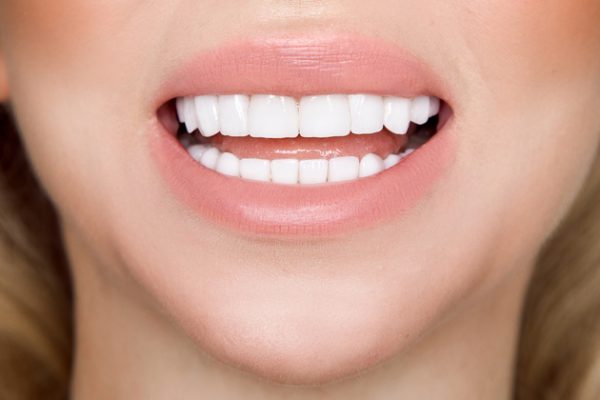 Porcelain Dental Veneers