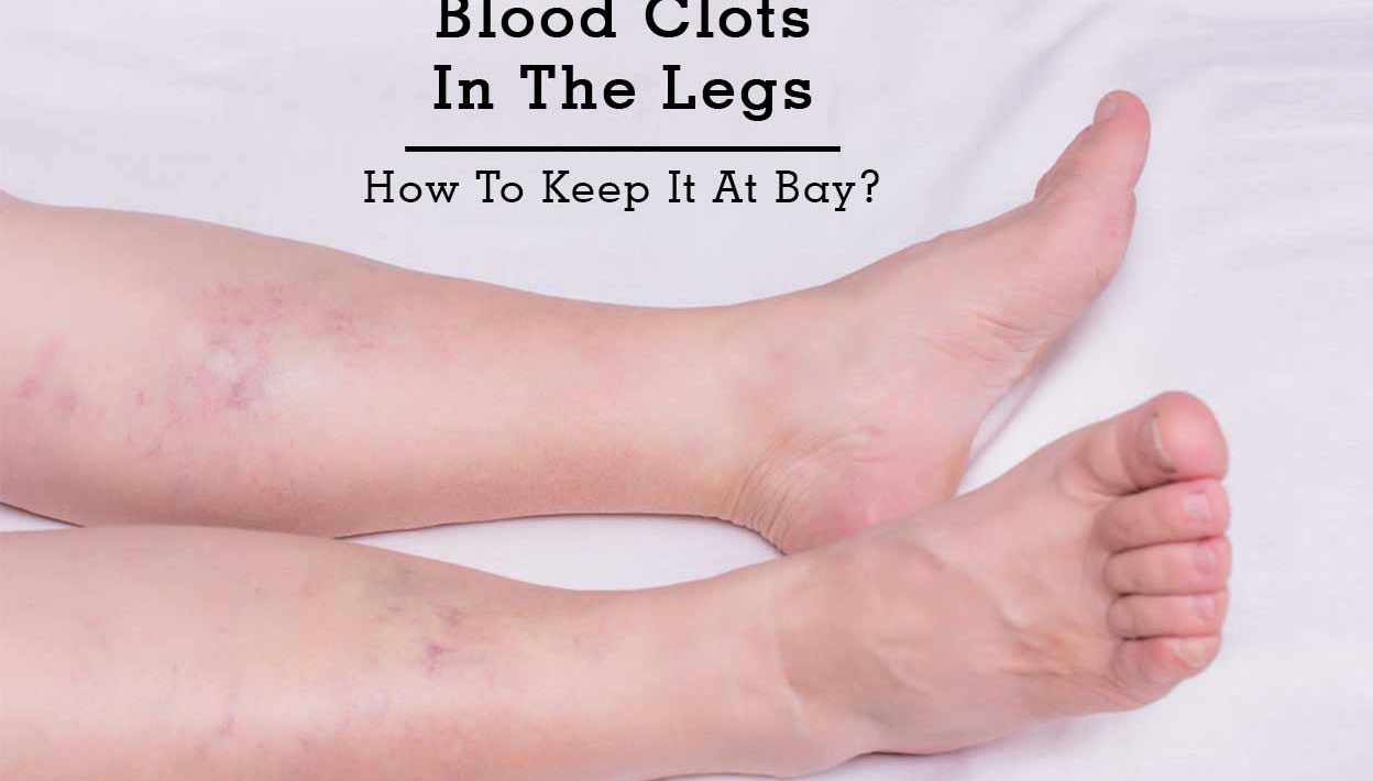 blood clot in leg