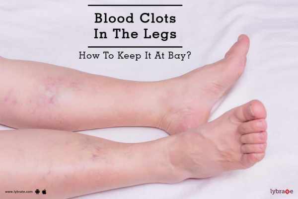 blood clot in leg