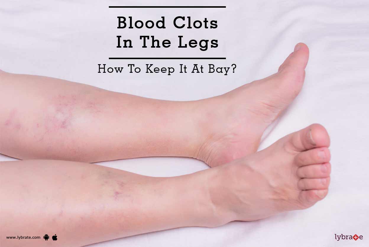 do blood clots travel down the leg