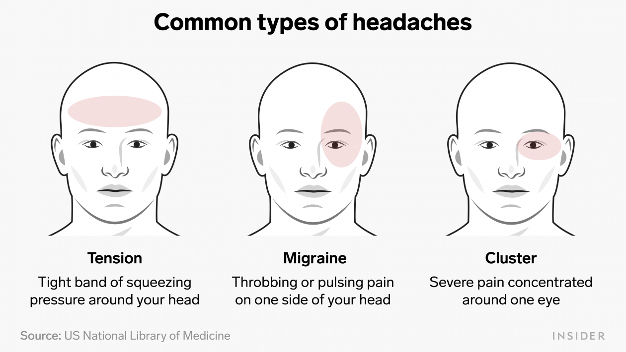 different types of headaches