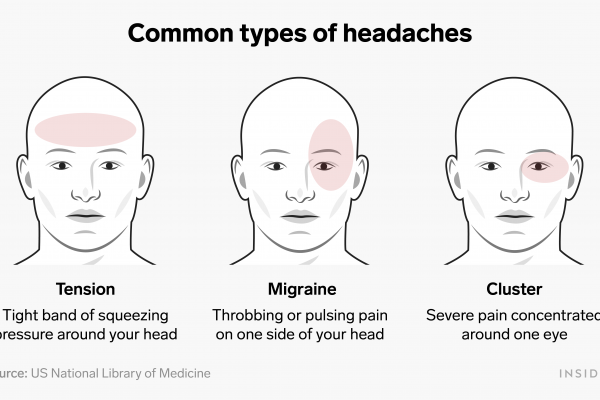 different types of headaches