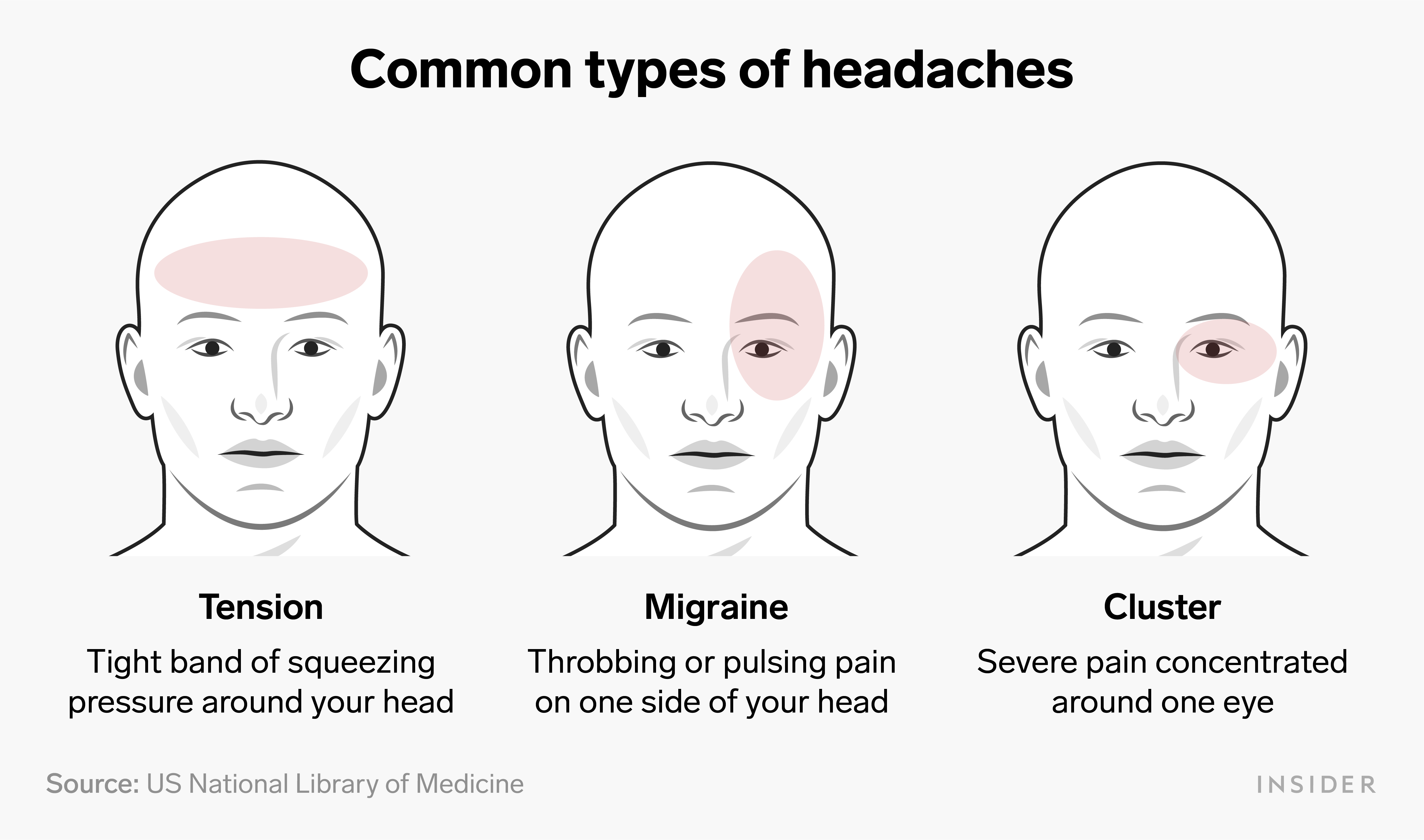 Headache Types