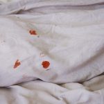 How To Remove Dried Blood Stains Using Common Household Items?
