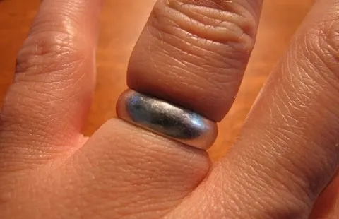 How to Reduce Swelling in Fingers to Remove Ring